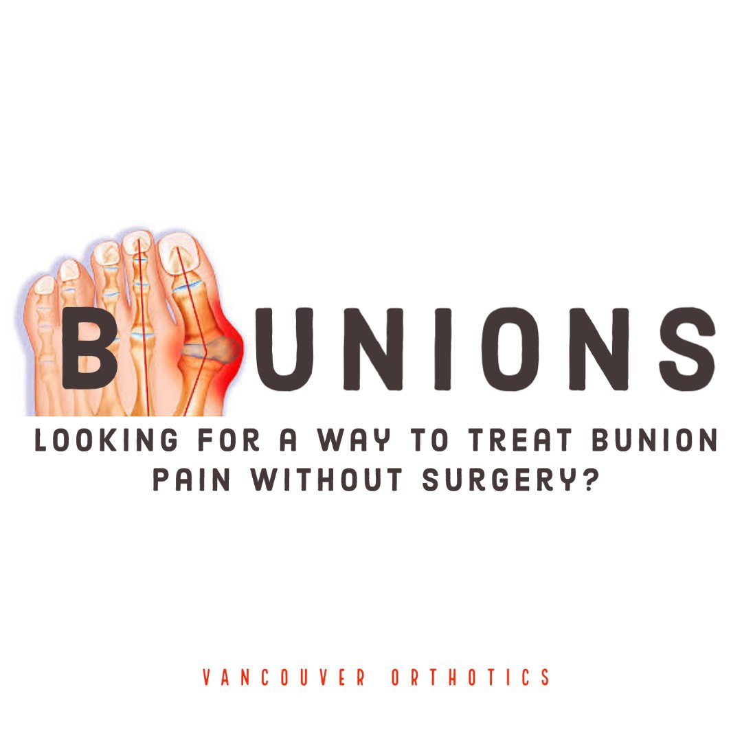 SpineDoc16's tweet photo. Hey Vancouver! Do you have Bunions or Bunnionettes? Are you Looking for Non-Surgical Options for Bunion Relief? Have Your Feet Examined at one of our Vancouver Orthotic Clinics. Call us Today at 604-737-3668 or Book Online for Relief! https://t.co/LzL6yexrbl https://t.co/MB3MsPpYBC