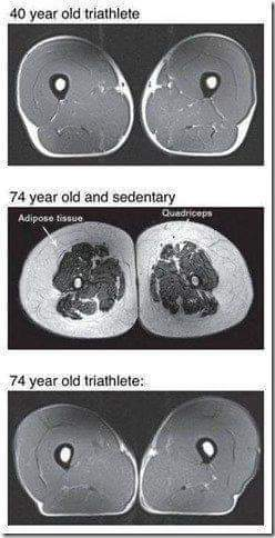 robertlufkinmd's tweet photo. What does this mean to you?

h/t @drvipulaggarwal https://t.co/3fVxY4dZq8