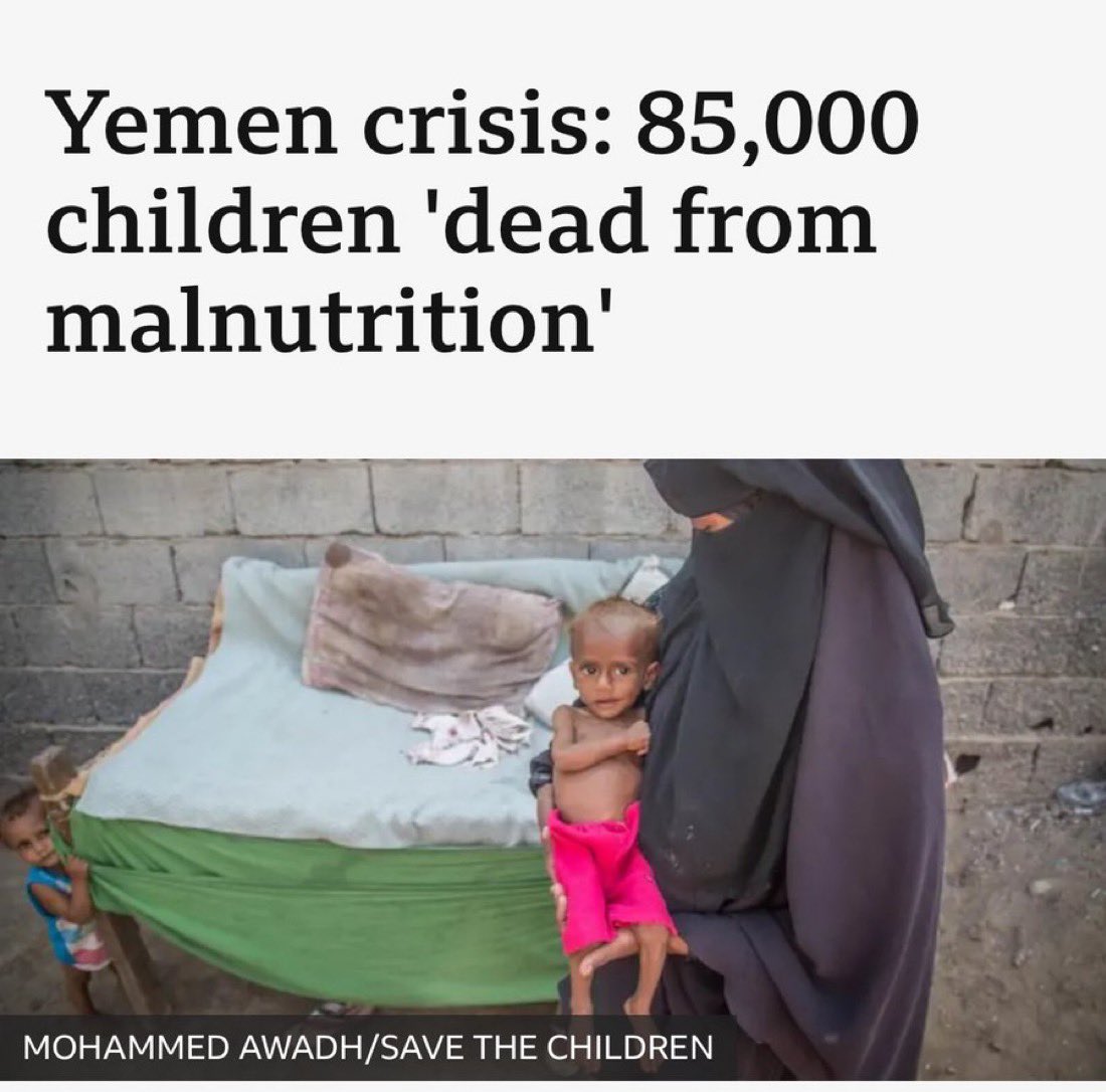 Iran is so worried about the Yemenite children, that they constantly send high value rockets.. to feed their population.