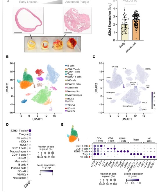 Circulation (@circaha) on Twitter photo Ezh2 in T cells regulates atherosclerosis @LarsMaeg
<a href="/5antus/">Donato Santovito</a>
<a href="/FlorianaFarina/">Floriana Farina</a>
<a href="/AtzlerLab/">Doro Atzler</a> ahajournals.org/doi/full/10.11… Ezh2 in T cells regulates atherosclerosis @LarsMaeg
<a href="/5antus/">Donato Santovito</a>
<a href="/FlorianaFarina/">Floriana Farina</a>
<a href="/AtzlerLab/">Doro Atzler</a> ahajournals.org/doi/full/10.11…