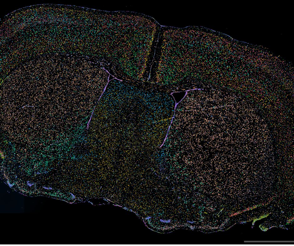 South Australian Genomics Centre (SAGC) (@sa_genomics) on Twitter photo No better time than autumn š for a 5K runs šāāļø with #XeniumInSitu. Recent mouse CNS section with the 5000 gene Prime panel at single-cell resolution. Proudly delivered by the team at <a href="/SA_genomics/">South Australian Genomics Centre (SAGC)</a> - Xenium Service Provider <a href="/10xGenomics/">10x Genomics</a> <a href="/mscienceaustnz/">Millennium Science</a> No better time than autumn š for a 5K runs šāāļø with #XeniumInSitu. Recent mouse CNS section with the 5000 gene Prime panel at single-cell resolution. Proudly delivered by the team at <a href="/SA_genomics/">South Australian Genomics Centre (SAGC)</a> - Xenium Service Provider <a href="/10xGenomics/">10x Genomics</a> <a href="/mscienceaustnz/">Millennium Science</a>