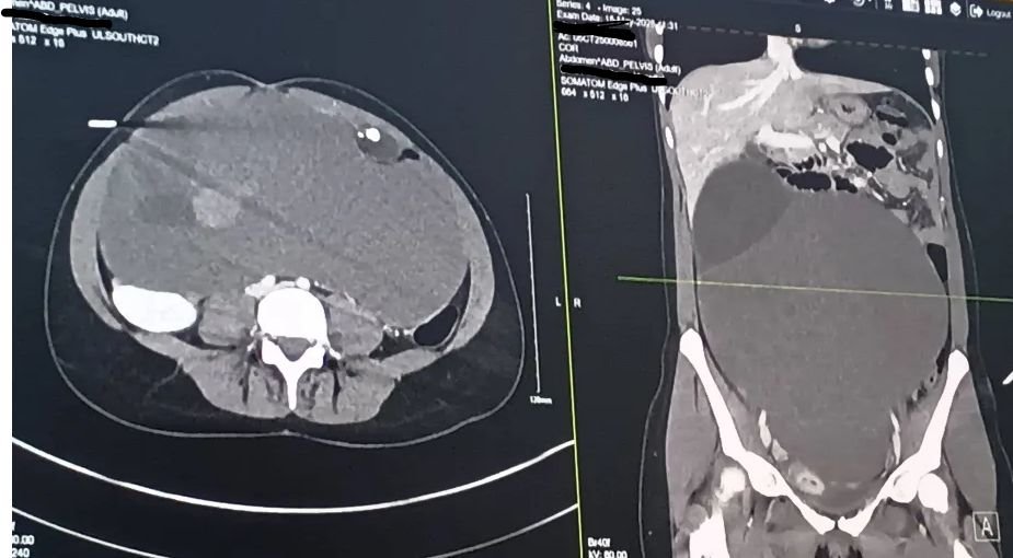KirinKlaws's tweet photo. Hi! This is my wifes spotfund for our financial needs. I just learned today I have a massive growth that's causing me severe abdominal pain, and I'm planning to get surgery soon to remove it.  Anything helps. We really need it. https://t.co/Lh2MKPU8ix