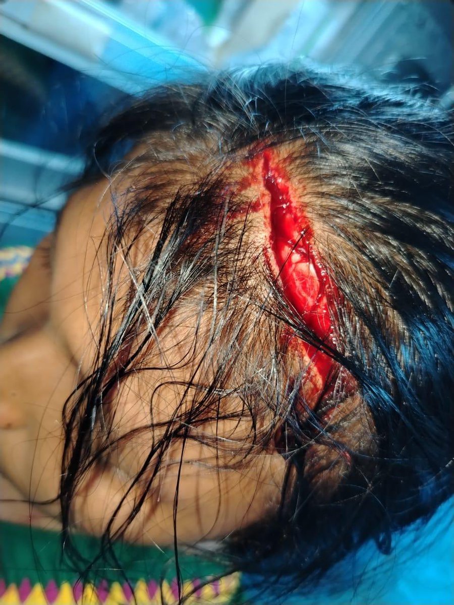 caton01's tweet photo. Quisiera escuchar lo que tendría que decir @DefensoriaPan y @CIDH en torno a la masacre que se genera en Panamá. https://t.co/s05VQDMiCs