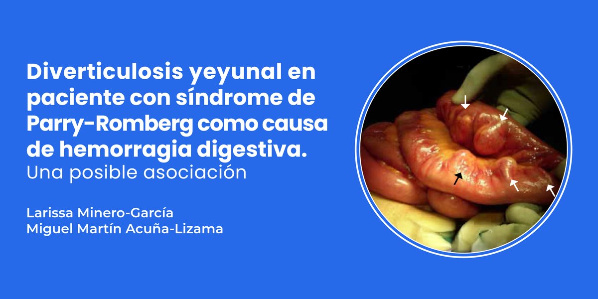actaMHA's tweet photo. Este caso clínico presenta la posible asociación entre síndrome de Parry-Romberg (SPR) y alteraciones gastrointestinales. Consúltalo aquí: https://t.co/1ekZepT2EE https://t.co/cyCgSLoU1z