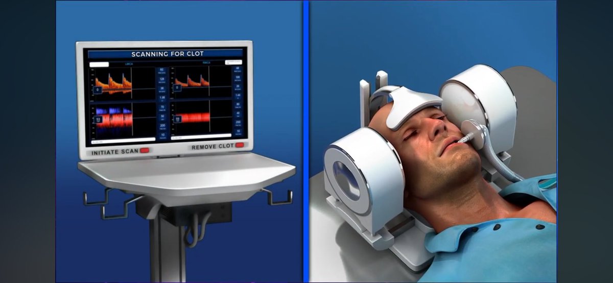 May 15 is Mechanical Thrombectomy Day — a reminder of how far we’ve come in stroke care and how far we still need to go. Proud to support <a href="/svinsociety/">SVIN</a> push for global MT access and our work at @Quantanosis to democratize LVO stroke treatment through innovation. <a href="/MThrombectomy/">Mission Thrombectomy</a>