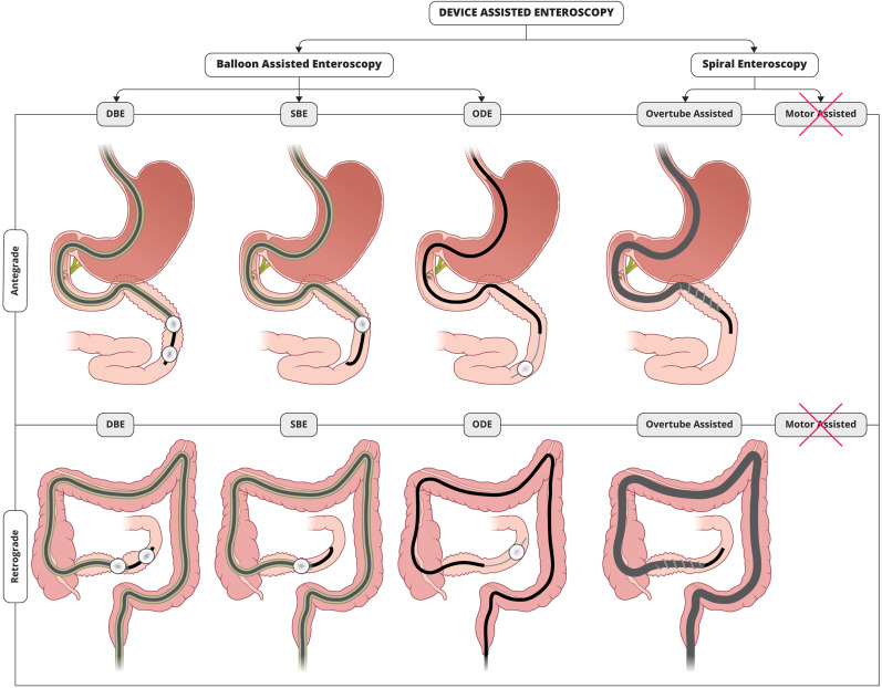 GIE (@gie_journal) on Twitter photo Editor’s Choice: Kadkhodayan and Irani detail "Clinical applications of device-assisted enteroscopy: a comprehensive review." giejournal.org/article/S0016-…
#GITwitter
<a href="/KambizKadkhoda2/">Kambiz Kadkhodayan</a> Editor’s Choice: Kadkhodayan and Irani detail "Clinical applications of device-assisted enteroscopy: a comprehensive review." giejournal.org/article/S0016-…
#GITwitter
<a href="/KambizKadkhoda2/">Kambiz Kadkhodayan</a>