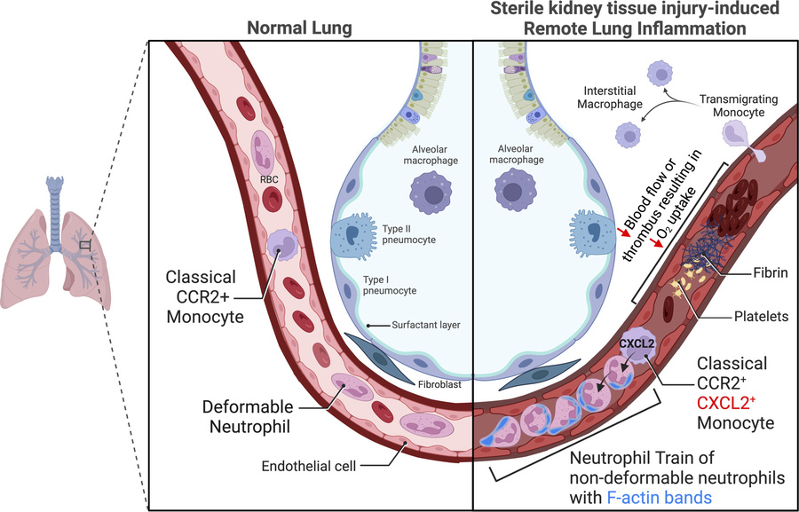 HerrlichLab (@herrlichlab) on Twitter photo We appreciate the commentary by Matt and Herold on our latest paper just published in <a href="/jclinicalinvest/">Journal of Clinical Investigation</a>
Acute kidney injury triggers neutrophil Traffic jam in lung capillaries: jci.org/articles/view/… We appreciate the commentary by Matt and Herold on our latest paper just published in <a href="/jclinicalinvest/">Journal of Clinical Investigation</a>
Acute kidney injury triggers neutrophil Traffic jam in lung capillaries: jci.org/articles/view/…