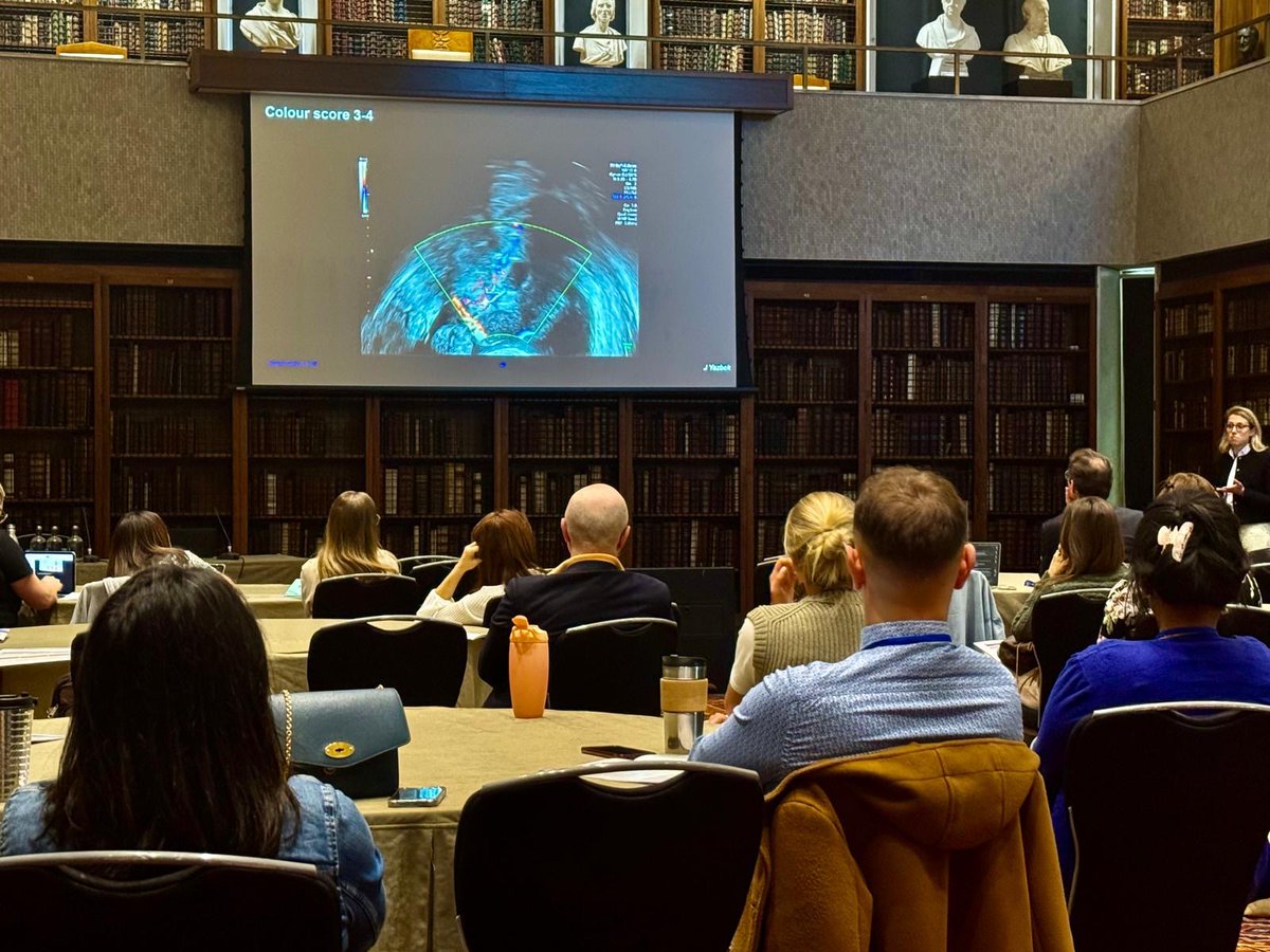 Expert Imaging in Obstetrics & Gynaecology (@expert_imaging) on Twitter photo Our second #Ultrasound in #Gynaecology speaker was Dr Jen Barcroft, Clinical Research Fellow in Reproductive Medicine, <a href="/imperialcollege/">Imperial College London</a> Healthcare NHS Trust.
This session focused on Case examples using IOTA ADNEX and the two step strategy to characterise ovarian pathology Our second #Ultrasound in #Gynaecology speaker was Dr Jen Barcroft, Clinical Research Fellow in Reproductive Medicine, <a href="/imperialcollege/">Imperial College London</a> Healthcare NHS Trust.
This session focused on Case examples using IOTA ADNEX and the two step strategy to characterise ovarian pathology