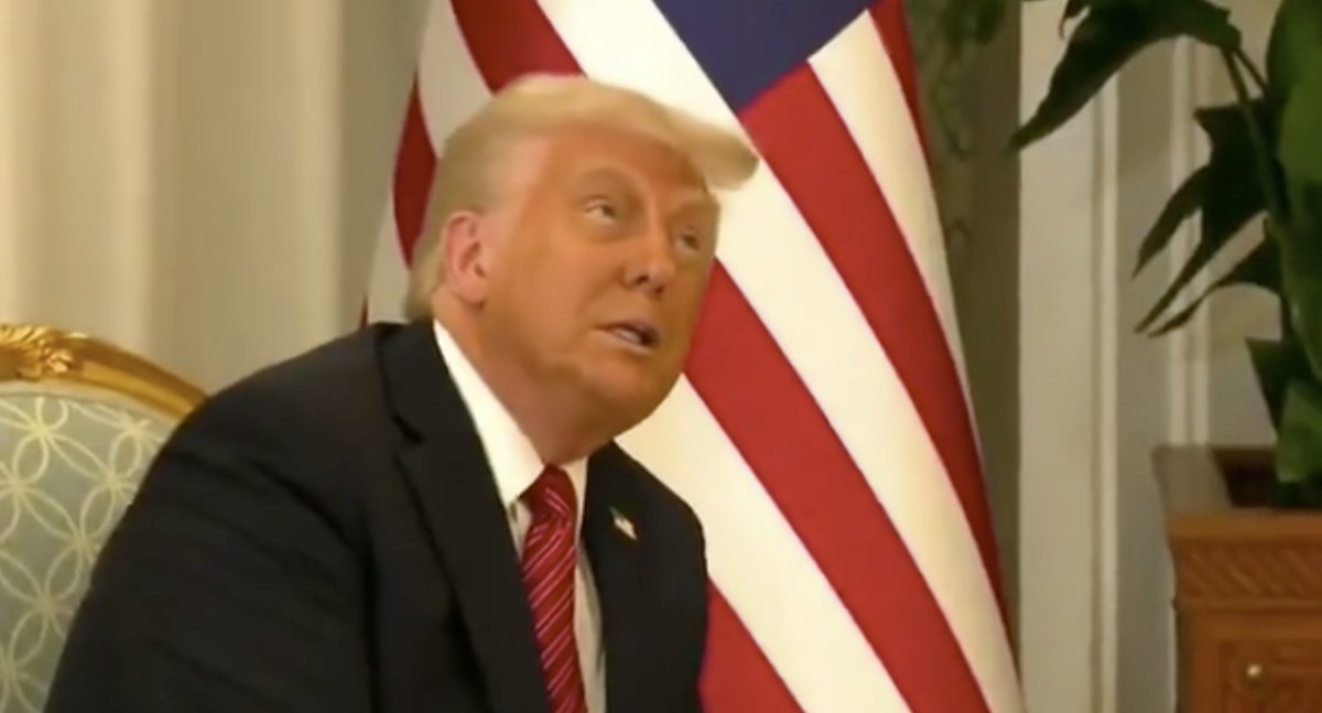 His face bro... 😂 he really has to stop wearing that shit.