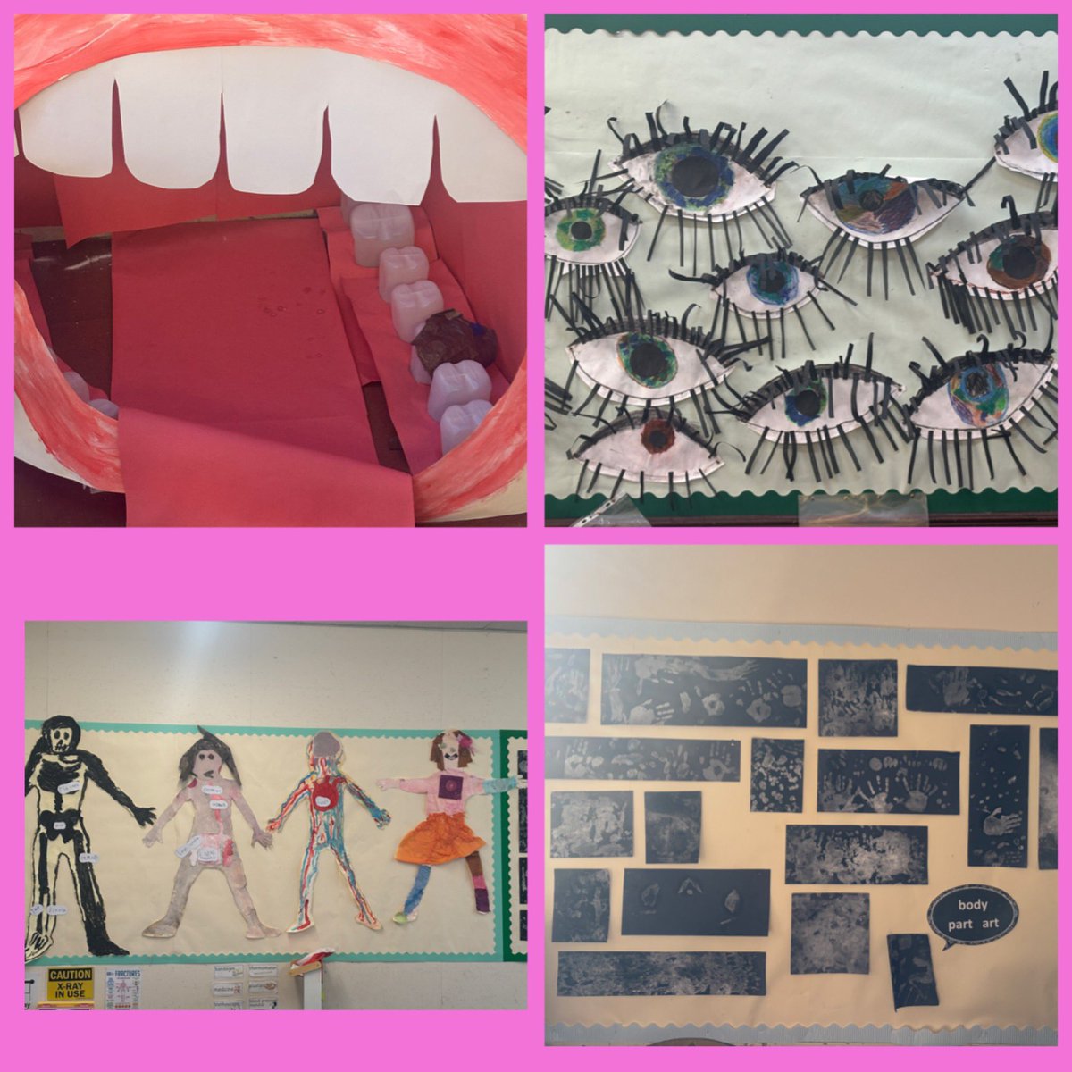 We had a local Artist visit the Infant department. She helped us create some amazing Art all linked to our topic on ‘the body!’ #AberdeenLearns <a href="/CulterSchool/">Culter School and Nursery</a>