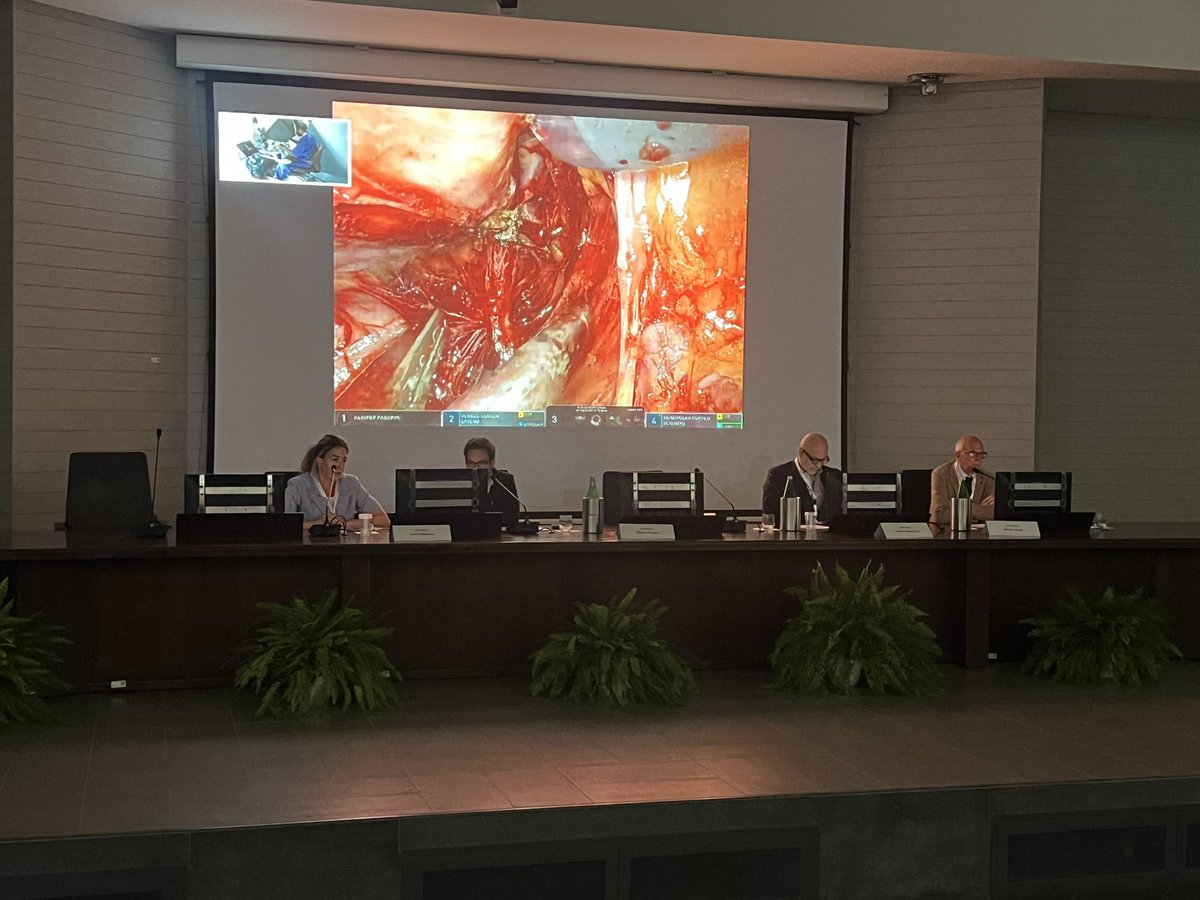 Synergy_Uro's tweet image. 🔴🎥 Live surgery session now at #SynergyCongress — and it’s top-tier!
👨⚕️ At the console: Dr. Matteo Massanova performing a RARC with ileal conduit 🤖🩺
🎙️ Moderated by an outstanding panel: Prof. Minervini, Prof. L. Mertens, Prof. Annino & Prof. Longo 🌍💬