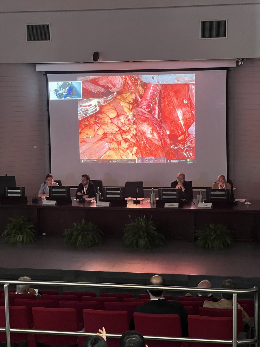Synergy_Uro's tweet image. 🔴🎥 Live surgery session now at #SynergyCongress — and it’s top-tier!
👨⚕️ At the console: Dr. Matteo Massanova performing a RARC with ileal conduit 🤖🩺
🎙️ Moderated by an outstanding panel: Prof. Minervini, Prof. L. Mertens, Prof. Annino & Prof. Longo 🌍💬