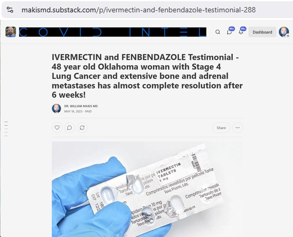 MakisMedicine's tweet photo. NEW ARTICLE: IVERMECTIN and FENBENDAZOLE Testimonial - 48 year old Oklahoma woman with Stage 4 Lung Cancer and extensive bone and adrenal metastases has almost complete resolution after 6 weeks!

This one came in today with a PET/CT scan yesterday.

It was too good not to post right away! 😃

STORY:
On Jan.22, 2025, 48 year old Oklahoma woman was diagnosed with Stage 4 Lung Cancer with extensive metastases to bones, lymph nodes and adrenal glands.

In early Feb.2025, she had surgery on her cervical spine because it was unstable from a metastasis.

On April 1, 2025 we started:

Ivermectin 1.5mg/kg/day

Fenbendazole 1500mg/day

RESULTS (after 6 weeks) (PET/CT May 15, 2025):

- LUL Primary lesion currently 1.5cm and SUVmax 3.5,  from previously 3.1cm and SUVmax 12.3

- LUL 8mm nodule was previously 1.7cm
- LUL 1.1cm nodule was previously 2.5cm
- decrease in size of additional lung nodular opacities

- decrease in size and FDG uptake of intrathoracic and supraclavicular lymph nodes

- bilateral adrenal metastases are no longer hypermetabolic

- decrease in FDG uptake in multiple bone metastases

My Take…

48 year old woman with a diagnosis of Stage 4 lung cancer and extensive metastases. What a shocking diagnosis to be faced with.

I'm not sure how this cancer patient found me but she didn't wait long.

After only 6 weeks of high dose Ivermectin and Fenbendazole, most of the cancer is gone.

LUL Primary 3.1cm to 1.5cm = 89% volume shrinkage

LUL 2.5cm to 1.1cm = 92% shrinkage

LUL 1.7cm to 0.8cm = 90% shrinkage

From the patient:

" Really incredible news from the doc this morning!...my metastases are melting away. The doc was pretty excited. My whole PET scan use to be lit up, but now it's almost nothing!"

"I couldn't be more thankful!" 😃

My cancer patients are the best!! 
They always make my day🙏

Lung Cancer has among the most dramatic responses to the Ivermectin and Fenbendazole combination I have seen in the past year.

I run the world's largest Ivermectin Cancer Clinic.

The entire project started with my Ivermectin and Fenbendazole articles on Sub.stack that went viral internationally in 2023.

After a dozen advanced stage cancer patients came to me with success stories from following my sub.stack articles, I decided to launch the Ivermectin Cancer Clinic in July 2024. 

It has been a wild ride. I will focus on the positives:

@joerogan read my viral Fenbendazole article on his show with Graham Hancock. I'm still not sure he can pronounce "Fenbendazole" correctly 😉

@delbigtree invited me on his show @HighWireTalk and our episode was so good it went viral.

Dr.John Campbell @Johnincarlisle did a 2 hour Interview with me which went viral and is still up on Youtube. I highly recommend it.

@HealthRanger did an interview with me which also went viral and was watched by millions around the world...so many cancer patients watch his show!

One of Mel Gibson's close friends came to me shortly after I started the Clinic and had tremendous success. Mel Gibson briefly talked about it on Joe Rogan's Podcast.

Cancer patients come to me from all around the world. Sometimes I'm truly shocked. 

Today's international patient highlights include: 

11 year old from Macedonia
71 year old from Barbados
66 year old from Bosnia & Herzegovina
64 and 66 year olds from Australia
75 year old from Taiwan
and several from the United States including 3 from Texas! 😃

I honestly don't know where cancer patients are finding me, but much of it seems to be via word of mouth.

We're busier than ever! 
But we help everyone we can. 

Article Link in photo to avoid shadowban, just re-type the URL in the first photo at the top, into your browser to access.

@elonmusk