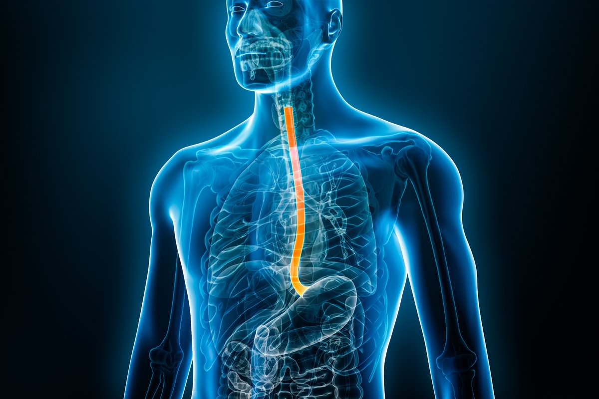 UCD Research (@ucd_research) on Twitter photo Got chronic heartburn? Up to 5% of people with #Barretts develop #OesophagealCancer but diagnosis & early intervention could save your life.
On #worldbarrettsday read about the <a href="/PrecisionOncIre/">Precision Oncology Ireland</a> team whose huge impact has saved many lives #ResearchisCare
imt.ie/news/an-illnes… Got chronic heartburn? Up to 5% of people with #Barretts develop #OesophagealCancer but diagnosis & early intervention could save your life.
On #worldbarrettsday read about the <a href="/PrecisionOncIre/">Precision Oncology Ireland</a> team whose huge impact has saved many lives #ResearchisCare
imt.ie/news/an-illnes…