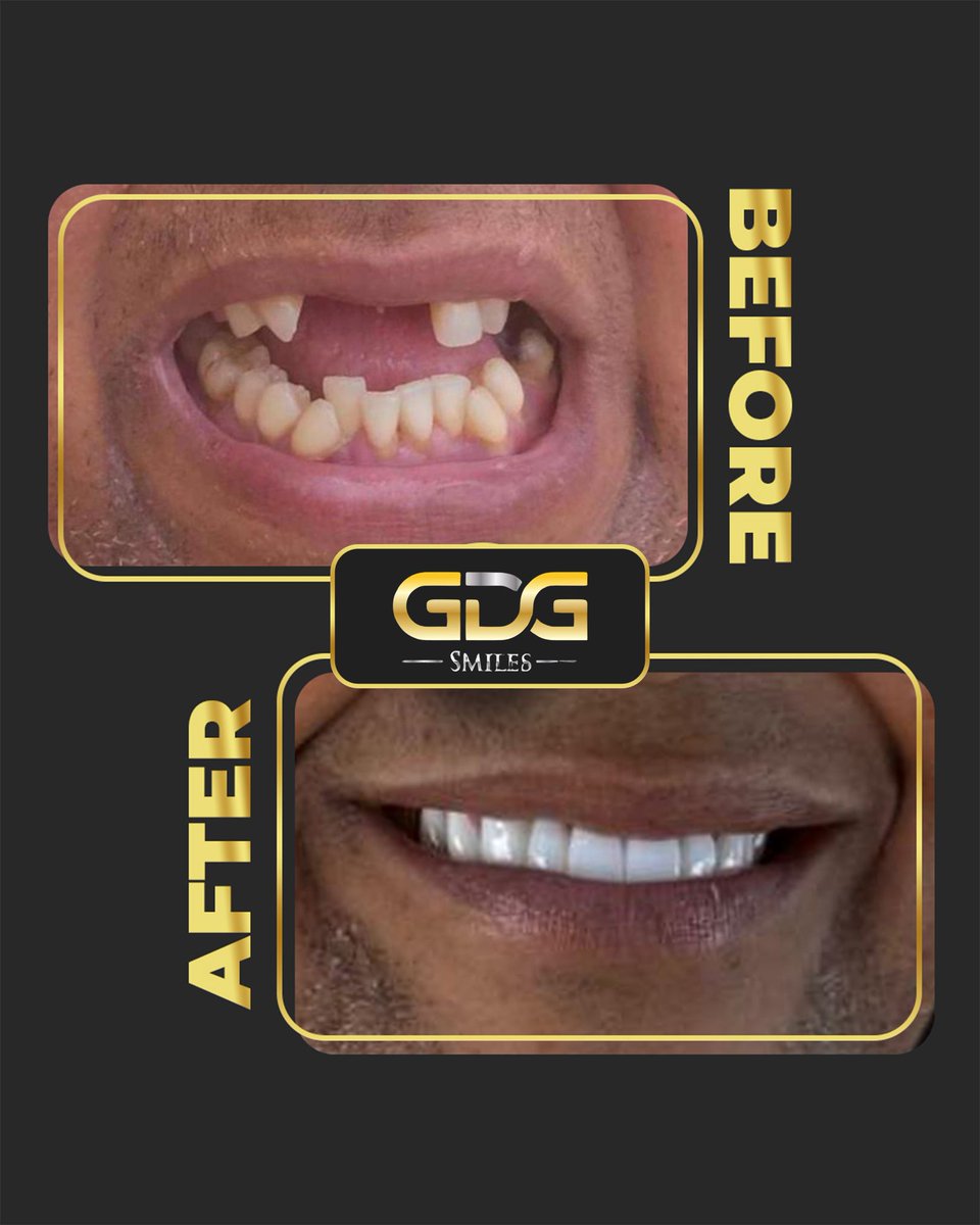 GDG Smiles tweet media