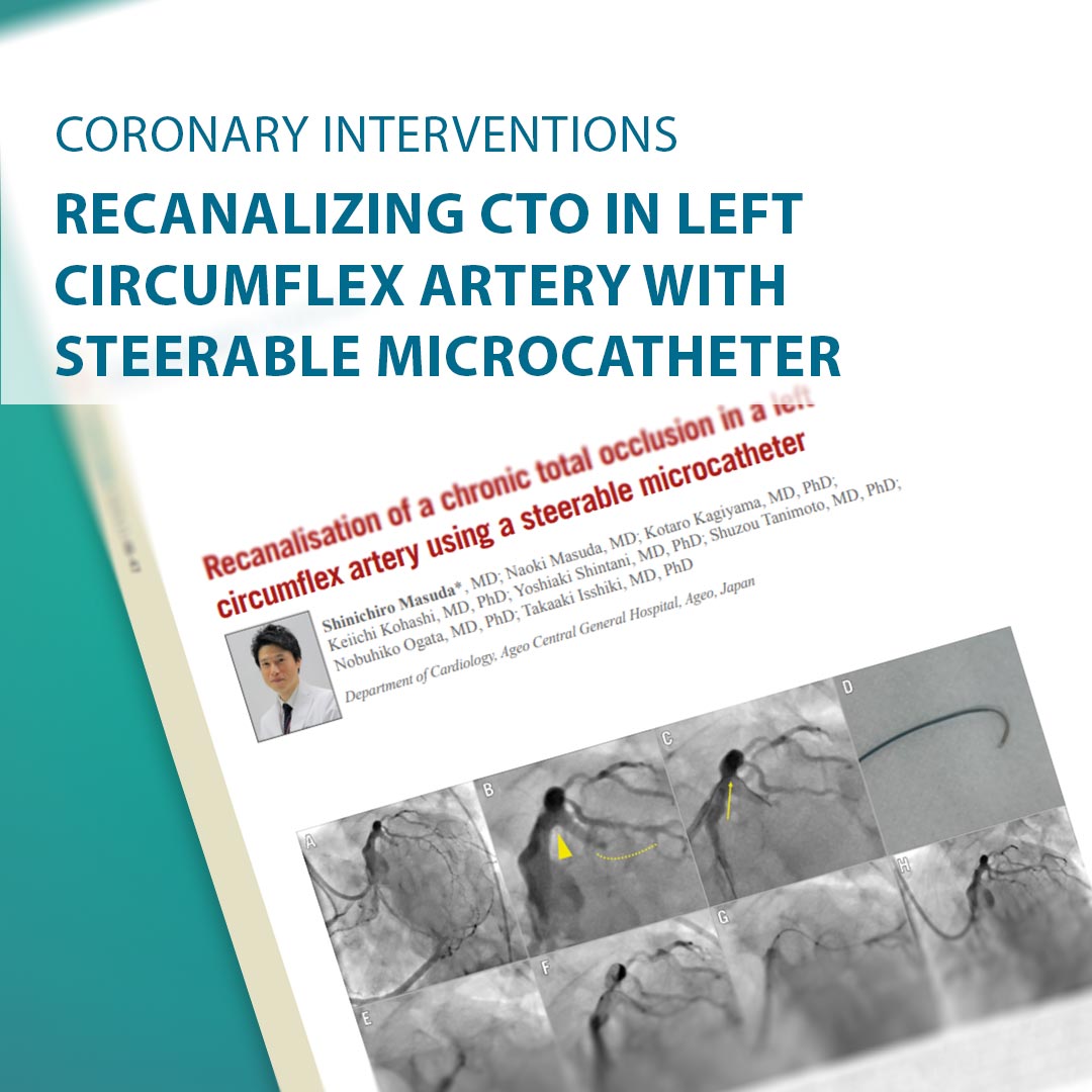 AsiaInterv's tweet image. 🚀 Steerable microcatheter aids complex CTO PCI in LCx with severe tortuosity. Game-changer for tough anatomies! 💡🫀

🔗 Full study:
asiaintervention.org/article/recana…

#PCI #CTO #Cardiology #Innovation #MedicalDevices #Intervention