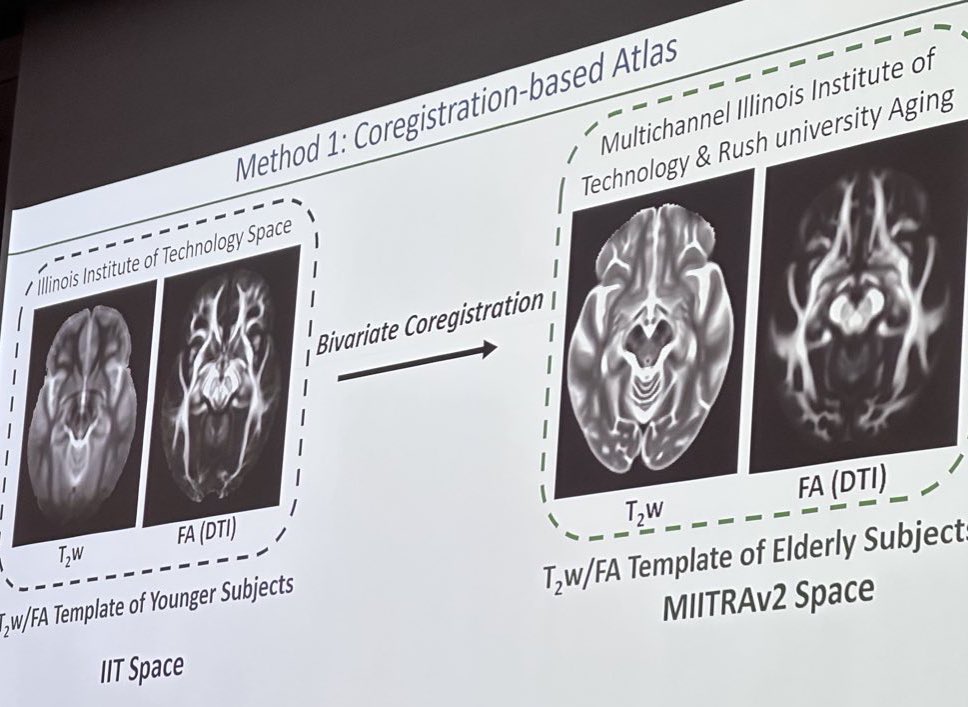 The Brainstem Navigator atlas for older adults is constructed in the space of our #MIITRA atlas. We are so proud to see our MIITRA atlas “host” these detailed, unique, brainstem labels developed <a href="/MGHMartinos/">MGH Martinos Center</a> Beautiful and much needed work <a href="/Subhranil_K/">Subhranil Koley</a> <a href="/BianciardiMarta/">Marta Bianciardi</a>! #ISMRM2025