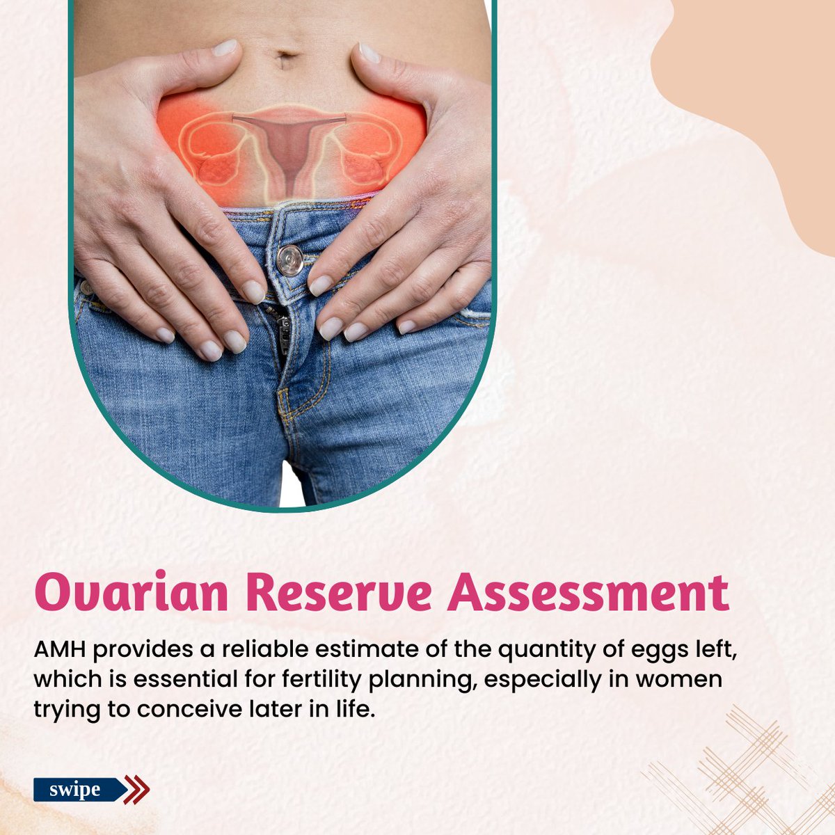 radhakrishnaivf's tweet image. 🧬 AMH is a key hormone that reveals your ovarian reserve and helps predict your fertility potential.

𝐜𝐚𝐥𝐥 𝐮𝐬 𝐨𝐧: 9663160764

#AMHLevels #OvarianReserve #FemaleFertility #HormoneHealth #ReproductiveHealth #TryingToConceive #FertilityEducation #KnowYourAMH
