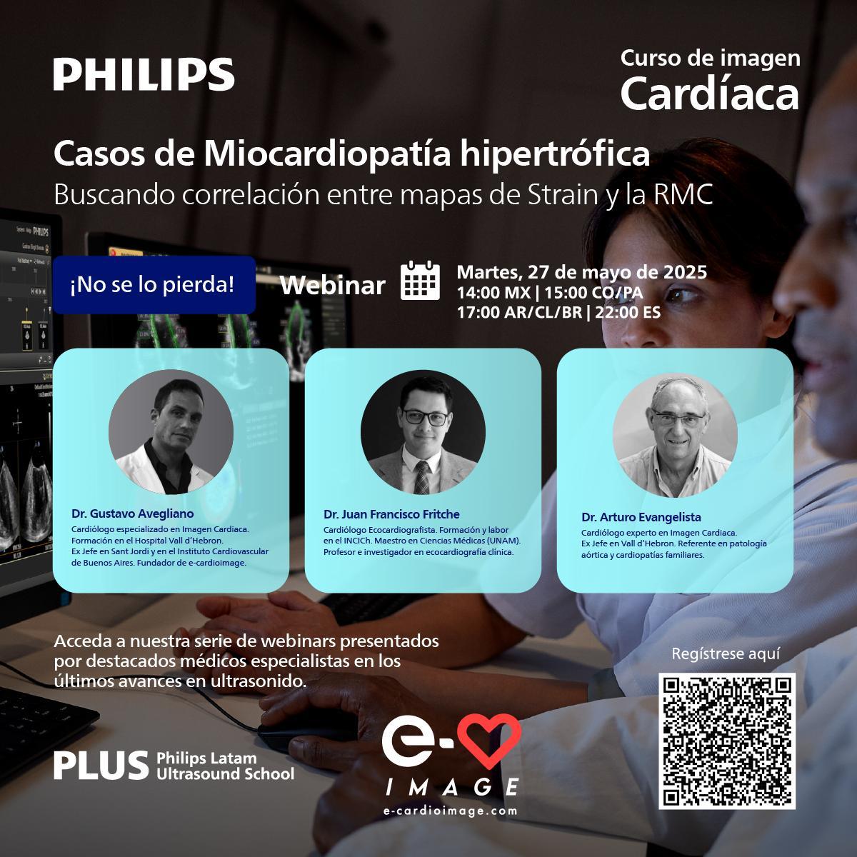 e-cardioimage (@ecardioimage) on Twitter photo 🎓📷 ¡Vuelve el webinar de
<a href="/ecardioimage/">e-cardioimage</a>
junto a Philips LATAM Ultrasound School!
📷 27/05 - 📷 14:00 MX | 17:00 AR | 22:00 ES 📷
📲 ¡Registrate escaneando el QR del flyer! 🎓📷 ¡Vuelve el webinar de
<a href="/ecardioimage/">e-cardioimage</a>
junto a Philips LATAM Ultrasound School!
📷 27/05 - 📷 14:00 MX | 17:00 AR | 22:00 ES 📷
📲 ¡Registrate escaneando el QR del flyer!