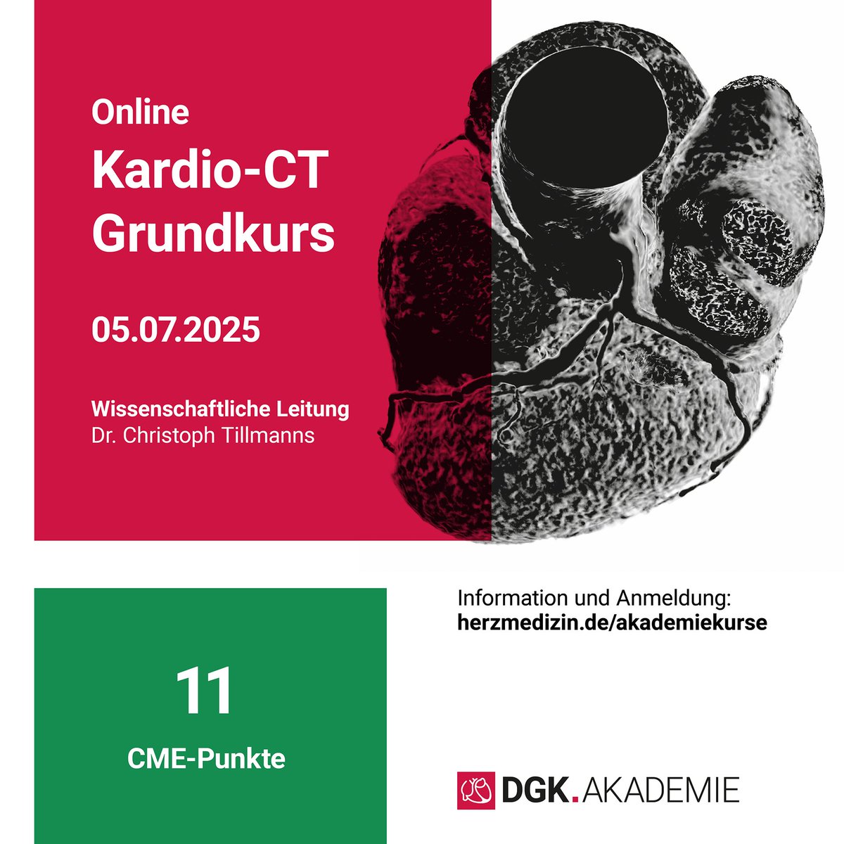 #DGKAkademie:
Online: Kardio-CT Grundkurs am 05.07.2025!
Dieser Kurs vermittelt das Potential und die Limitationen dieser Untersuchungsmethode in Vorträgen und praktischen Übungen.
📅 9-17:15 Uhr
🎓 11 CME-Punkte
➡️herzmedizin.de/fuer-aerzte-un…
#DGK #Kardiologie
