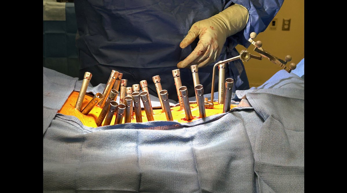 andrewchanMD's tweet image. 👏🏻Thank you to @UofOklahoma @OU_Neurosurgery for the tremendous visiting professor honor and inviting me to give ground rounds today to share my work on Minimally Invasive Scoliosis Surgery
It was great to see old friends, including @graffeo, and see the enthusiasm for spine…