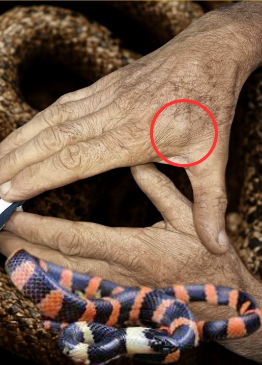 🧵 1/ EL ENVENAMIENTO QUE NO FUE Y EL SUERO QUE HACIA FALTA...

Hace poco, en una clínica privada de la región centro-occidental del país, un profesor jubilado fue mordido por lo que describió como una “posible coral”. ¿Qué ocurrió? Abro hilo 👇