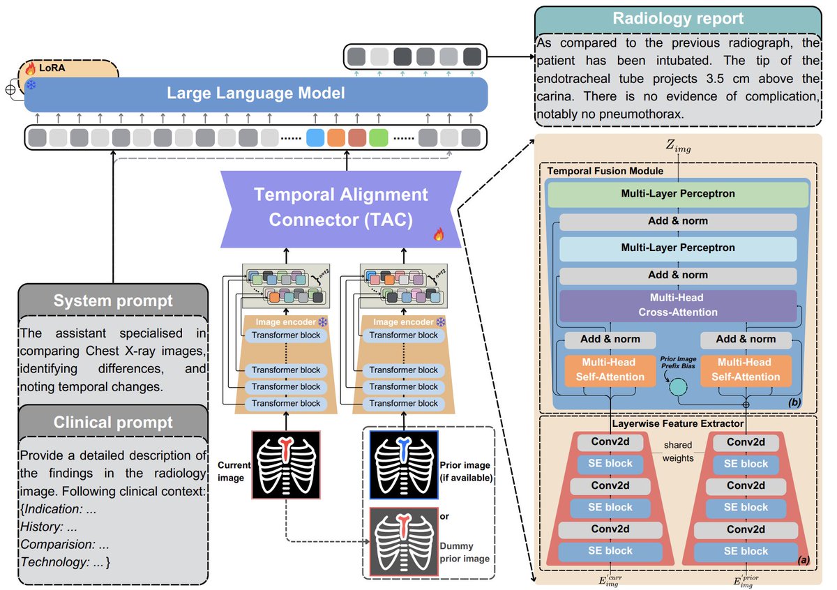 _xizhang's tweet image. ๐ Excited to share that our paper "Libra: Leveraging Temporal Images for Biomedical Radiology Analysis" (w/@mengzaiqiao, @jakelever0 & @EdmondSLHo) is accepted at #ACL2025!
๐ง TL;DR: We present Libra, a temporally-aware MLLM โ inspired by "structure determines function" โ toโฆ