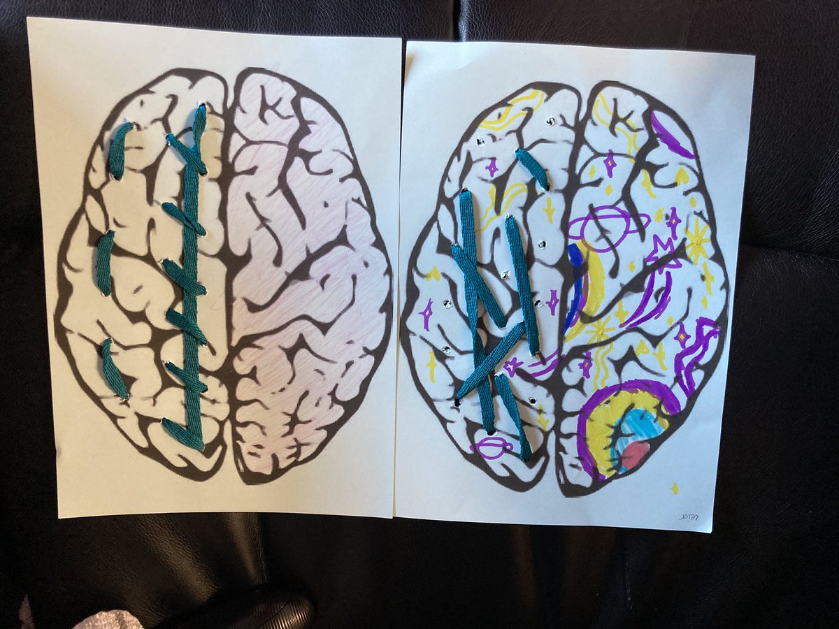 Nice interactive session today with Mr Collins and the diversity committee <a href="/WallacewellPS/">Wallacewell Primary School</a> talking about Tourettes Syndrome! They got creative supporting <a href="/tourettescot/">Tourette Scotland</a> shoelace campaign to kick off Tourettes Awareness Month. #TealforTourettes #TourettesAwarenessMonth2025