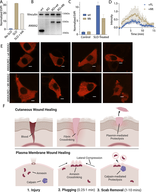 JCellBiol's tweet photo. Justin Krish Williams, Randy Schekman et al. @ucberkeley show that human cells shed extracellular vesicles in order to repair their membranes. https://t.co/hgS1mXxkc5 

#EVs #Exosomes https://t.co/F1pAvQlPIX