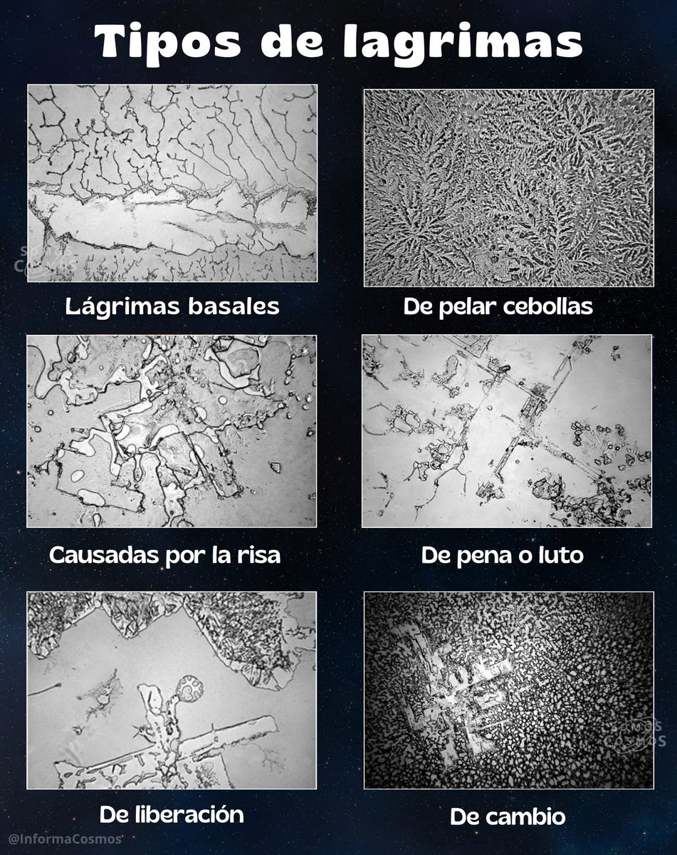 InformaCosmos's tweet photo. Un proyecto llamado The Topography of Tears fotografió distintos tipos de lágrimas bajo el microscopio. Se descubrió que las lágrimas emocionales, las de risa o las provocadas por la cebolla tienen estructuras completamente diferentes.

Cada una forma patrones únicos, casi como huellas digitales. Su trabajo muestra que nuestras emociones también pueden verse físicamente en formas microscópicas, mostrando una sorprendente complejidad visual y química que esconden unas simples gotas de agua salada.