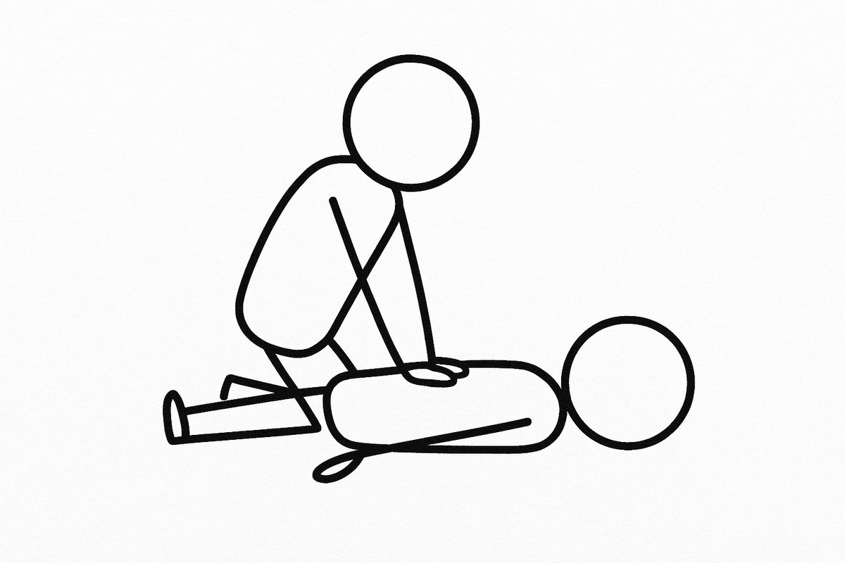 (1/x) Determining when to stop performing CPR for patients in cardiac arrest is hard and is not as precise as one might think...

This one case from my medical school days changed how I think / approach this 👇