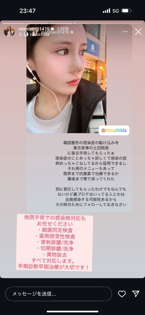 お米ちゃん 輪郭3点顎下筋肉縛り脂肪豊胸DT中 tweet media