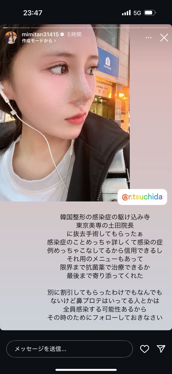 お米ちゃん 輪郭3点顎下筋肉縛り脂肪豊胸DT中 tweet media
