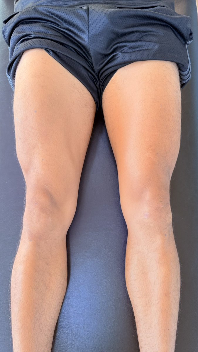 Filipe Abdalla tweet media