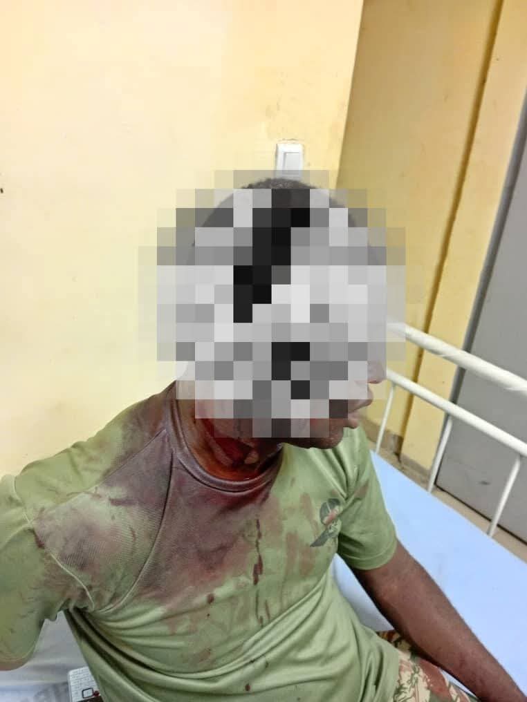 Au moins un militaire Camerounais blessé et un véhicule de l'armée détruit dans une nouvelle attaque attribuée à ISWAP à Wulgo (Nigeria) cette nuit.🇨🇲🇳🇬