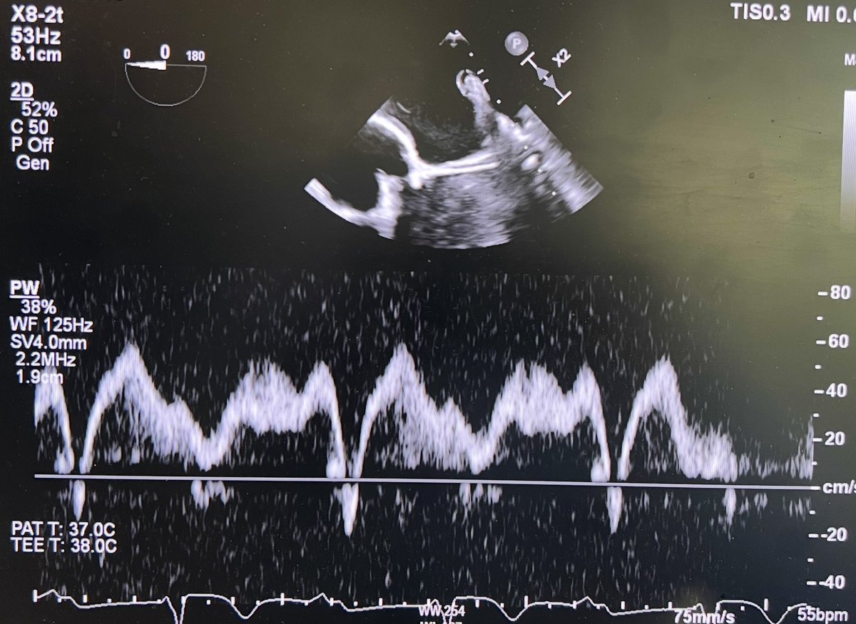 Chittur Sivaram MD MACP MACC tweet media