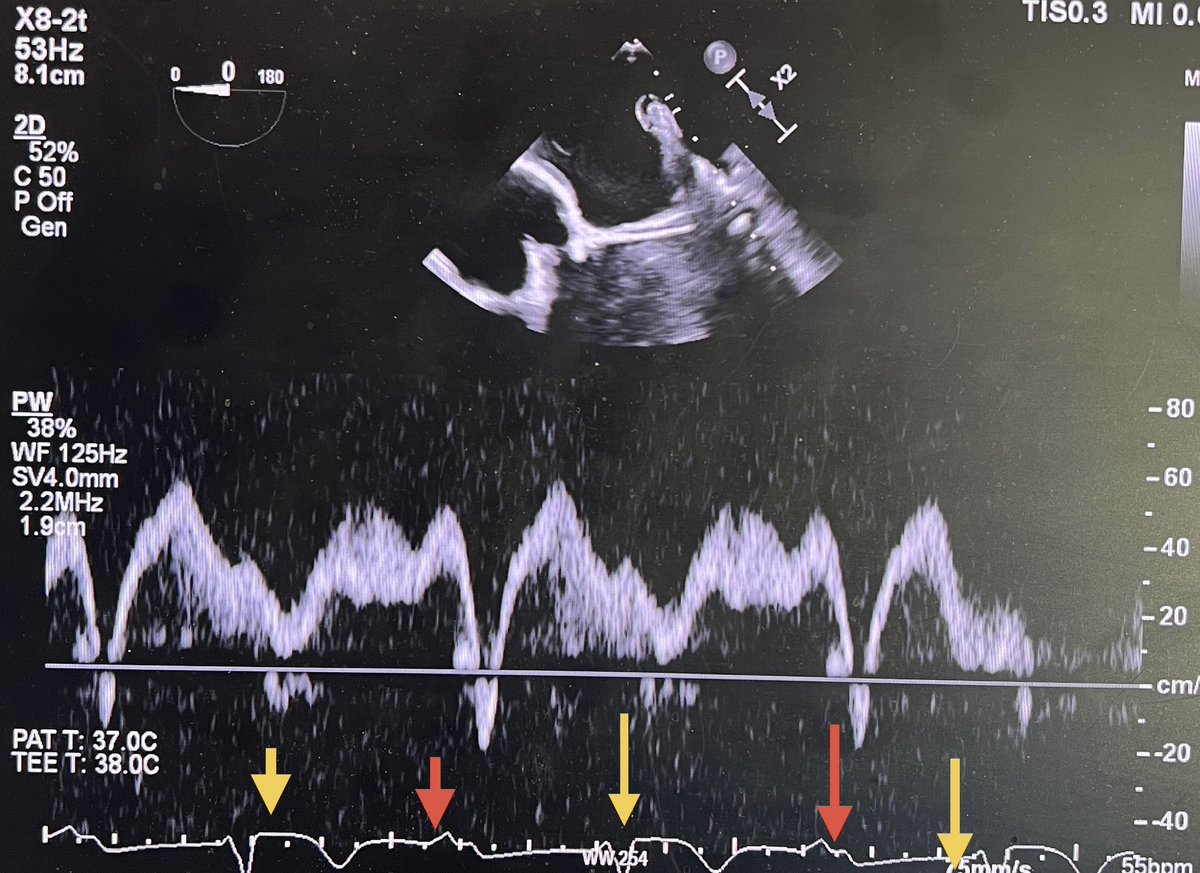 Chittur Sivaram MD MACP MACC tweet media