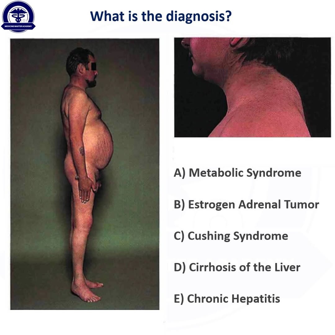 You are welcome to participate 😉 
#usmle #medschool #medicine #diagnosis #medicina #diagnostico #science #doctor