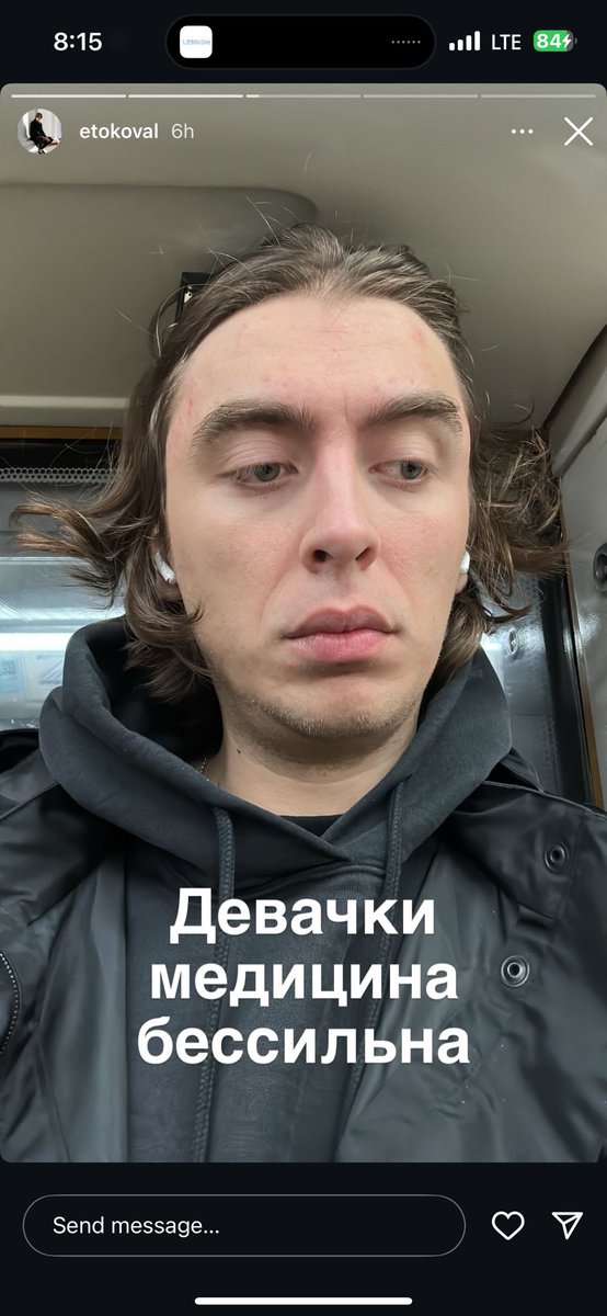 баги tweet media