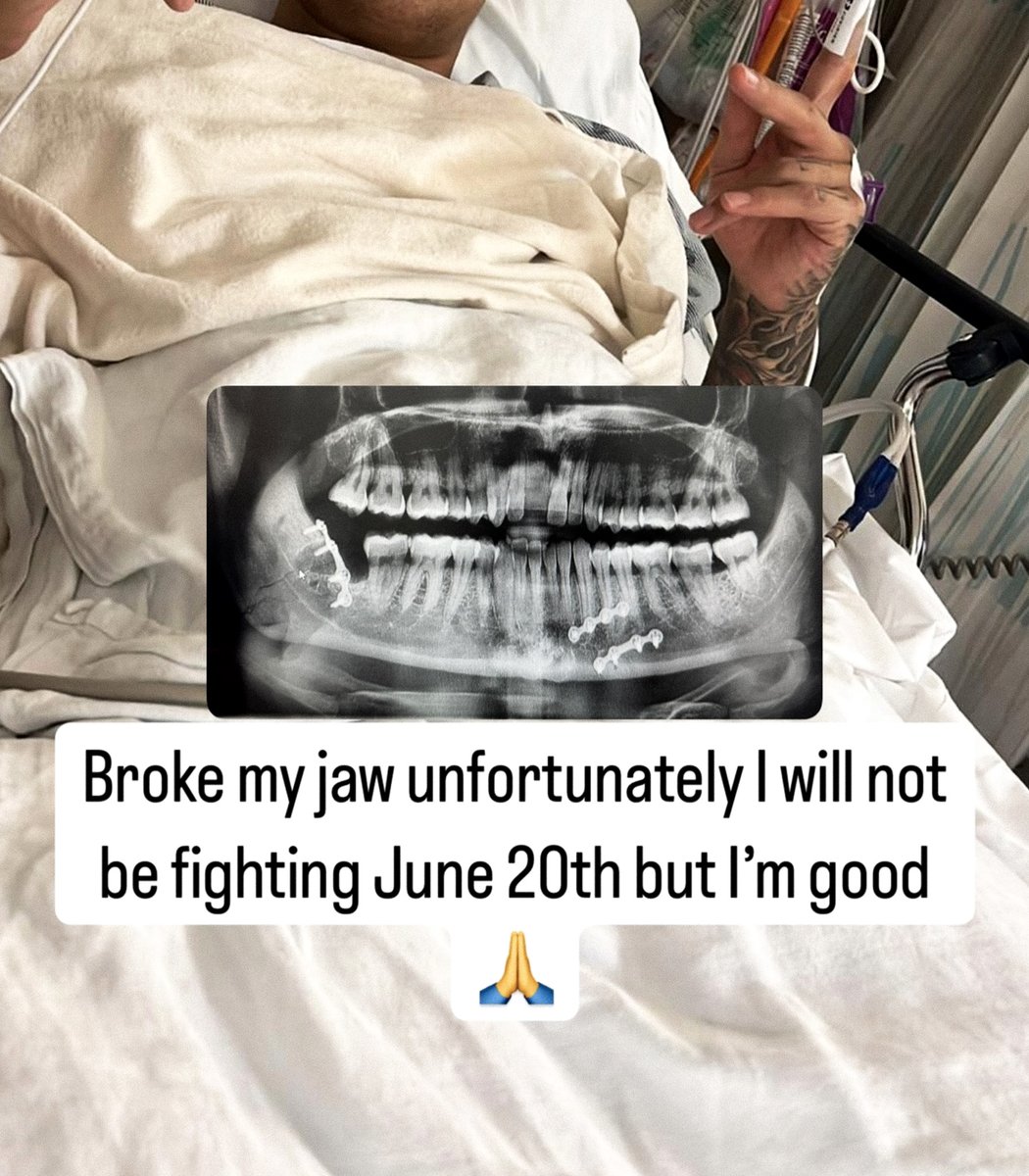 🗞️ #BREAKING: Jay Jay Wilson is OUT of his June 20 semi-final bout vs. Gadzhi Rabadanov in the PFL Lightweight Tournament due to a broken jaw.

He announced the news on his Instagram Story. PFL has yet to name a replacement.

(h/t <a href="/JoeyGamebred/">J. Torres</a>)