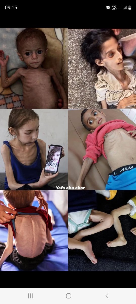 draliyoussef's tweet photo. American weapons, Israeli bombarding, no food, let the kids die starving! https://t.co/3jekaWFiAJ