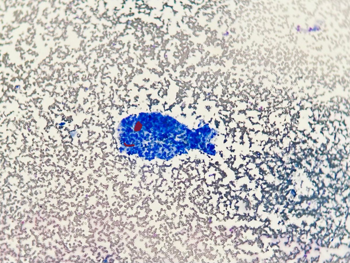 Look at my sweet little fish. :)
#thyroid #fnab 
#pathology #pathart #PathTwitter