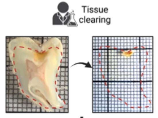 Sumeet Pal Singh (@sumeetpalsingh8) on Twitter photo Stunning 3D fluorescent images of the human tooth and the first cellular/molecular map of tooth decay! Hoang Thai Ha from <a href="/NicolasBaeyens/">Nicolas Baeyens</a> nails it with tissue clearing + imaging.
biorxiv.org/content/10.110… Stunning 3D fluorescent images of the human tooth and the first cellular/molecular map of tooth decay! Hoang Thai Ha from <a href="/NicolasBaeyens/">Nicolas Baeyens</a> nails it with tissue clearing + imaging.
biorxiv.org/content/10.110…