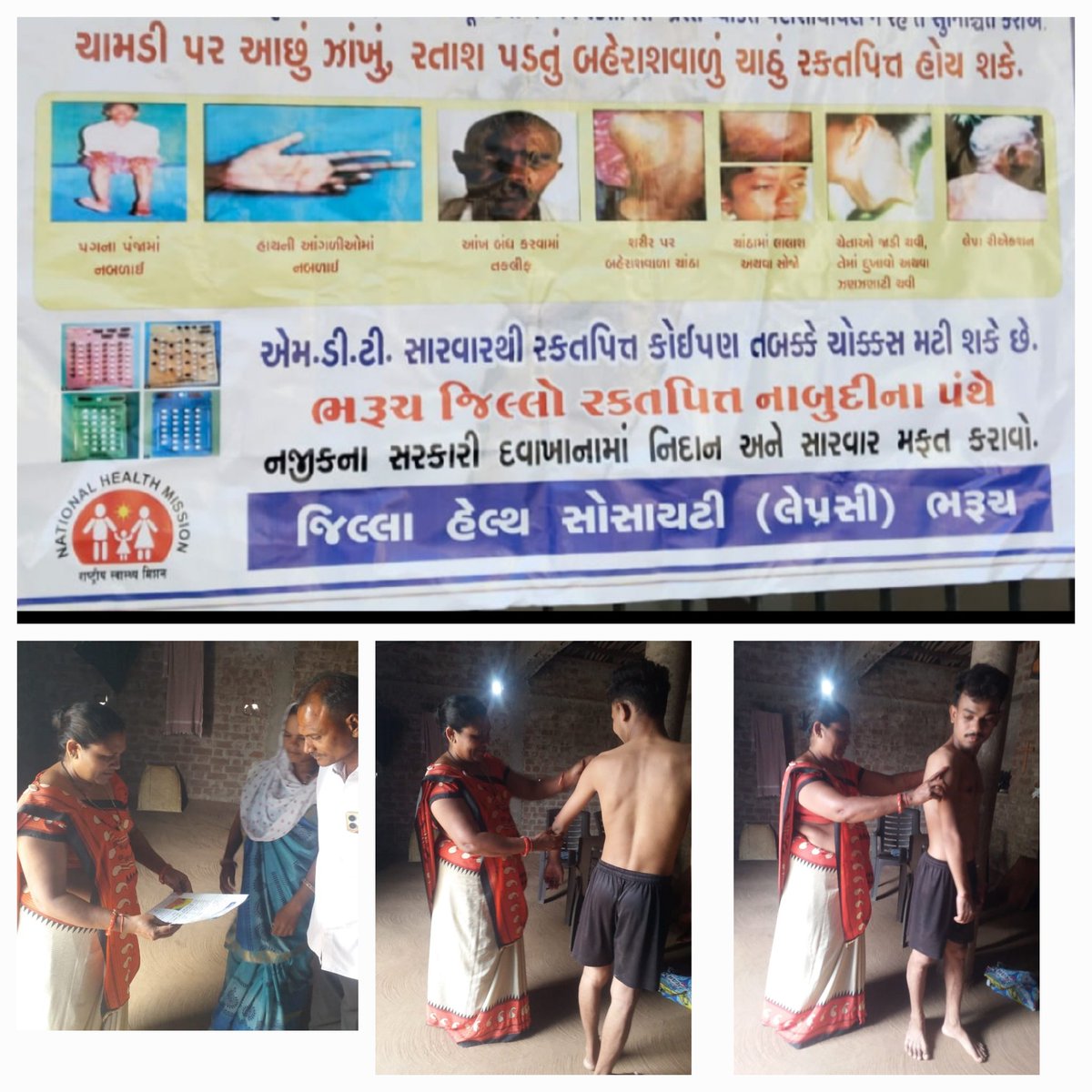 AAM_Valpor's tweet image. #3rd #friday 
#Leprocy #survey 
#AAMVALPORE
#PHCKHARETHA 
આજ રોજ આરોગ્ય કર્મચારીઓ દ્વારા #રક્તપિત્ત નું ગામમાં સર્વે કરવામાં આવેલ હતું,  જેમાં લોકોને યોગ્ય માહિતી આપી હતી અને રક્તપિત્ત વિશે જણાવ્યું હતું,
માહિતી પુસ્તિકા થકી યોગ્ય આરોગ્ય શિક્ષણ આપેલ હતું. 
@Bharuch_Health 
@ddo