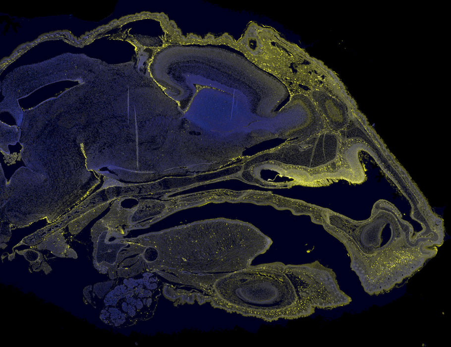 ScienceTM's tweet image. Antisense oligonucleotides injected into amniotic fluid led to healthier motor neurons, improved behavior and survival in mouse models of spinal muscular atrophy. @HopkinsMedicine @UCSFMedicine scim.ag/43kciJ4