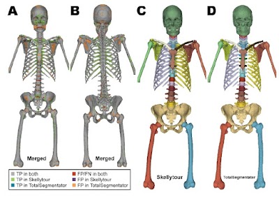 Radiology: Artificial Intelligence (@radiology_ai) on Twitter photo Skellytour achieved consistent bone segmentation performance on internal and external datasets doi.org/10.1148/ryai.2… <a href="/uamshealth/">UAMS Health</a> #MSKRad #segmentation #skeleton Skellytour achieved consistent bone segmentation performance on internal and external datasets doi.org/10.1148/ryai.2… <a href="/uamshealth/">UAMS Health</a> #MSKRad #segmentation #skeleton