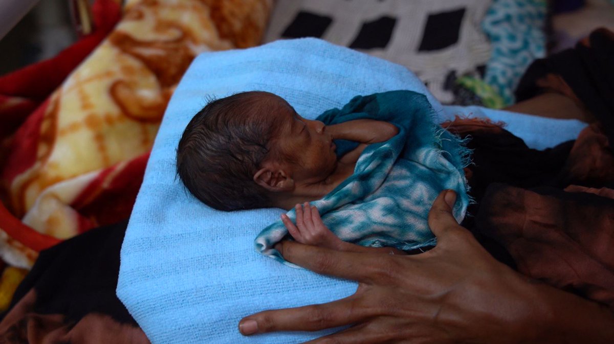 MediciSenzaFrontiere (@msf_italia) on Twitter photo “Facciamo quello che possiamo per salvarli”
Nella nostra clinica ad #Adré vediamo casi di malnutrizione gravi e per i quali servirebbero cure e strumenti specialistici.
Il nostro staff è lì per far fronte a questi e altri bisogni medici.
#propagandalive <a href="/welikeduel/">Propaganda Live</a> <a href="/mannocchia/">francesca mannocchi</a> “Facciamo quello che possiamo per salvarli”
Nella nostra clinica ad #Adré vediamo casi di malnutrizione gravi e per i quali servirebbero cure e strumenti specialistici.
Il nostro staff è lì per far fronte a questi e altri bisogni medici.
#propagandalive <a href="/welikeduel/">Propaganda Live</a> <a href="/mannocchia/">francesca mannocchi</a>