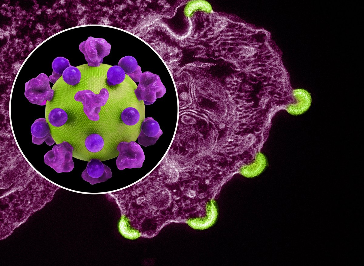 Have you ever seen the HIV virus?🤔 Now you have! Public health officials are trying to stop this virus in its tracks by working together with volunteers and experts to create an HIV vaccine. Until we do, it is important to learn how to prevent infection and stop the stigma.