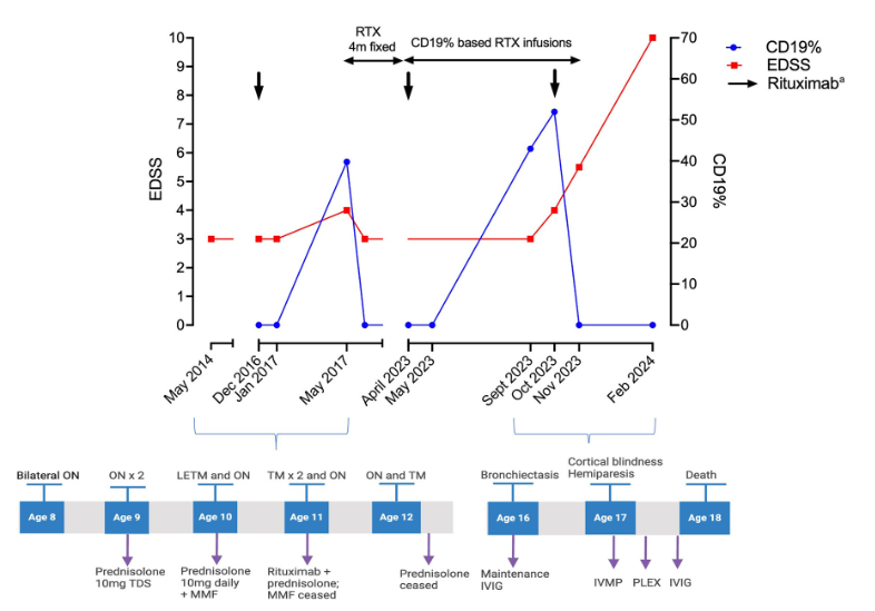 MSJ (@msj_research) on Twitter photo A 17-year-old boy with AQ4+ #NMOSD and treated with rituximab, had JCV+ progressive multifocal leukoencephalopathy #PML, which resulted into death.
Case report from <a href="/TheWaltonCentre/">The Walton Centre</a> <a href="/MonashUni/">Monash University</a> ▶️journals.sagepub.com/doi/full/10.11…
1/🧵 A 17-year-old boy with AQ4+ #NMOSD and treated with rituximab, had JCV+ progressive multifocal leukoencephalopathy #PML, which resulted into death.
Case report from <a href="/TheWaltonCentre/">The Walton Centre</a> <a href="/MonashUni/">Monash University</a> ▶️journals.sagepub.com/doi/full/10.11…
1/🧵