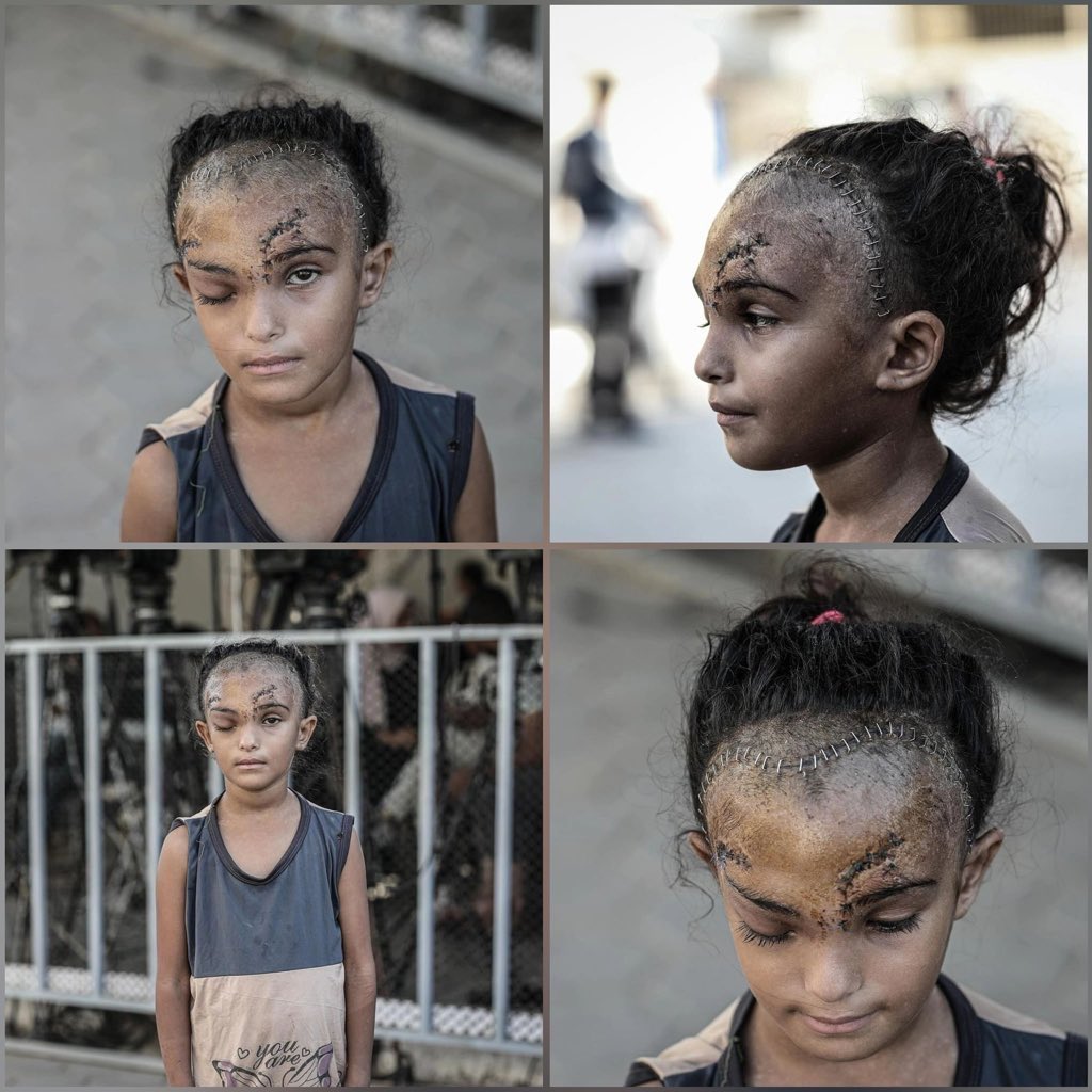 Dr. Yousef 🇵🇸 tweet media